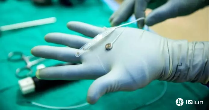 Neuralink竞争对手Paradromics完成首次人体脑植入测试