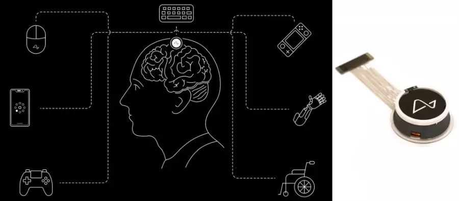 Neuralink将于英国展开临床实验
