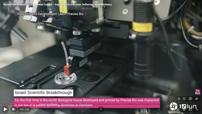 3D打印角膜首次成功移植 单一捐赠可制300枚植片